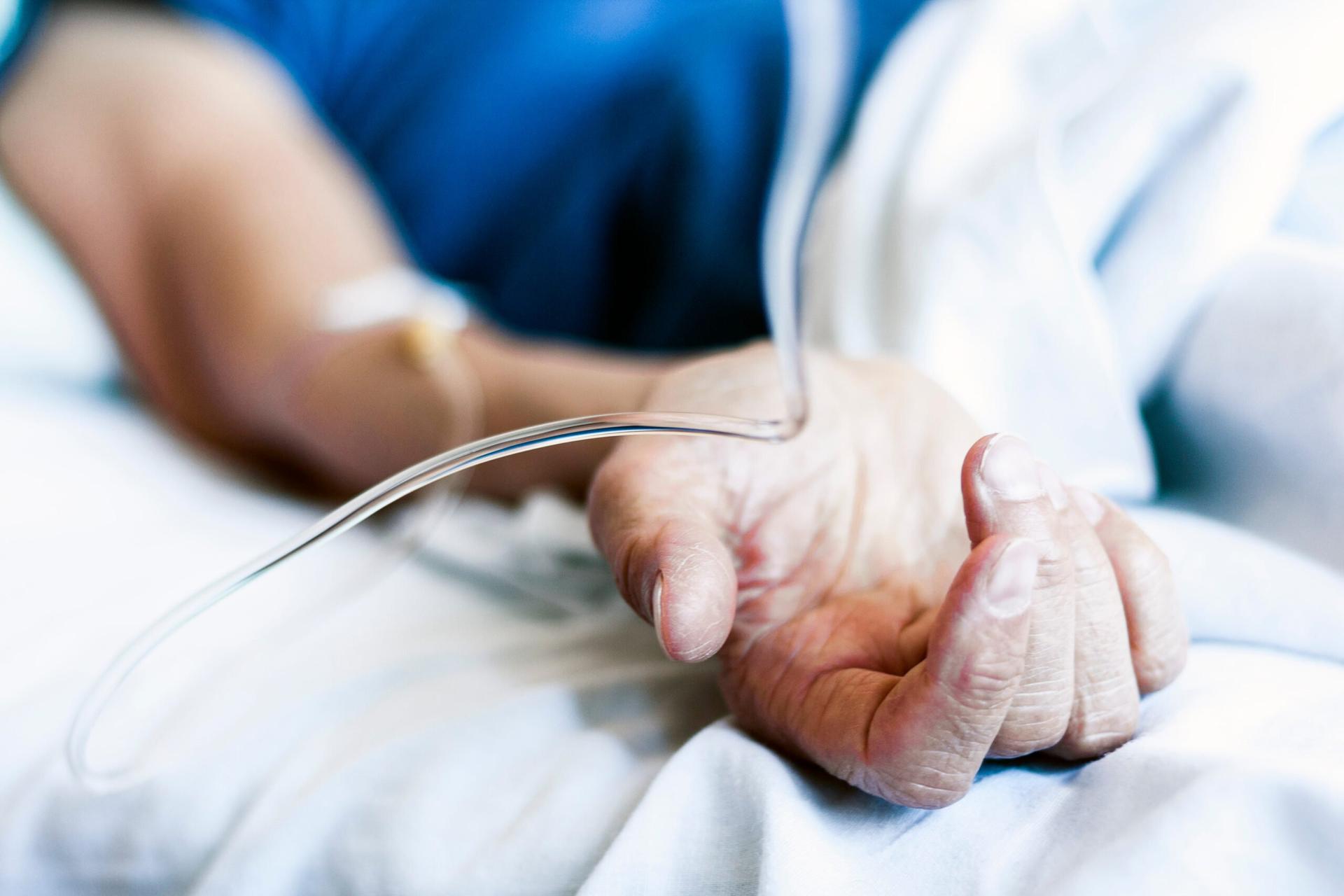 pendarahan otak tanpa gejala