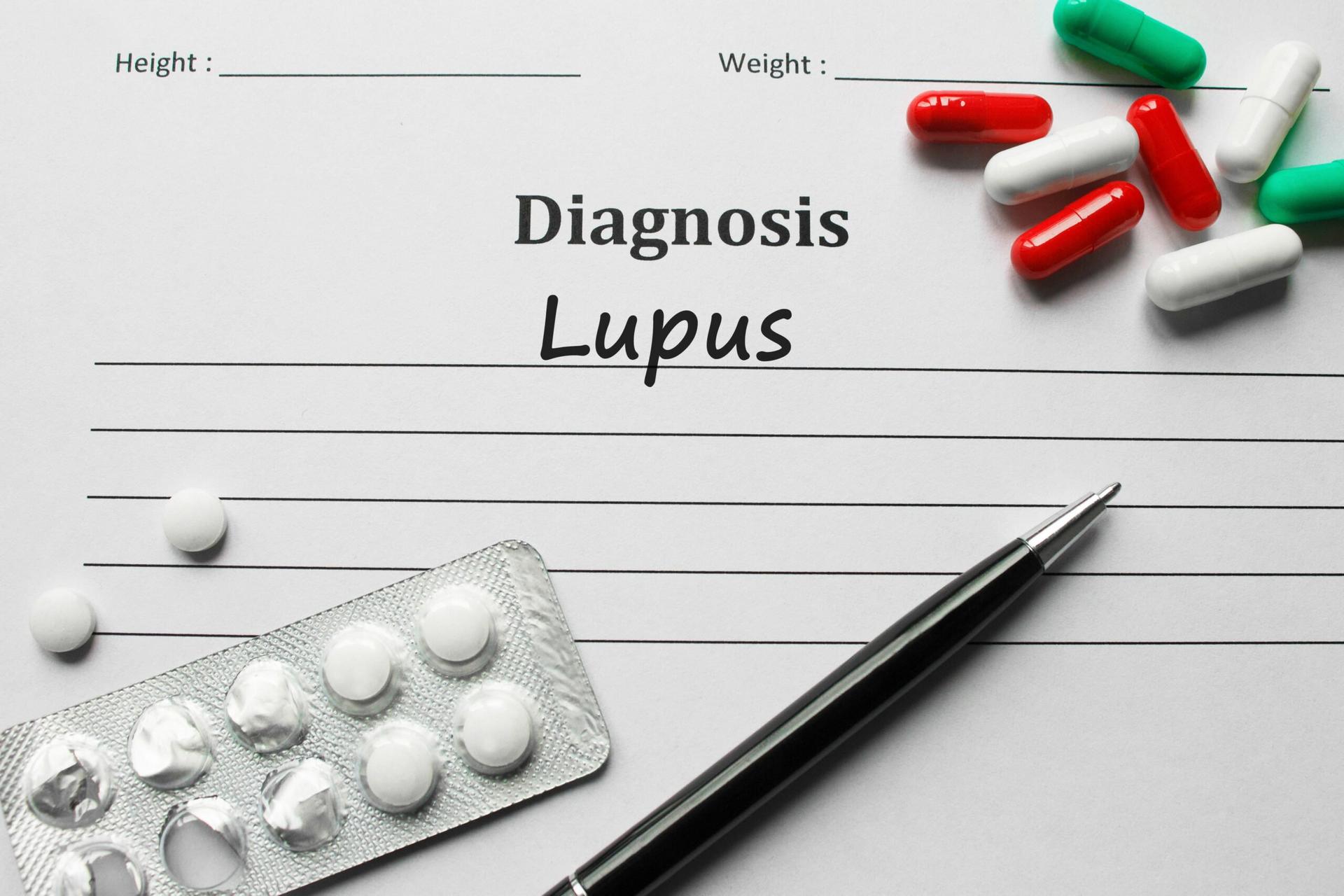 lupus
