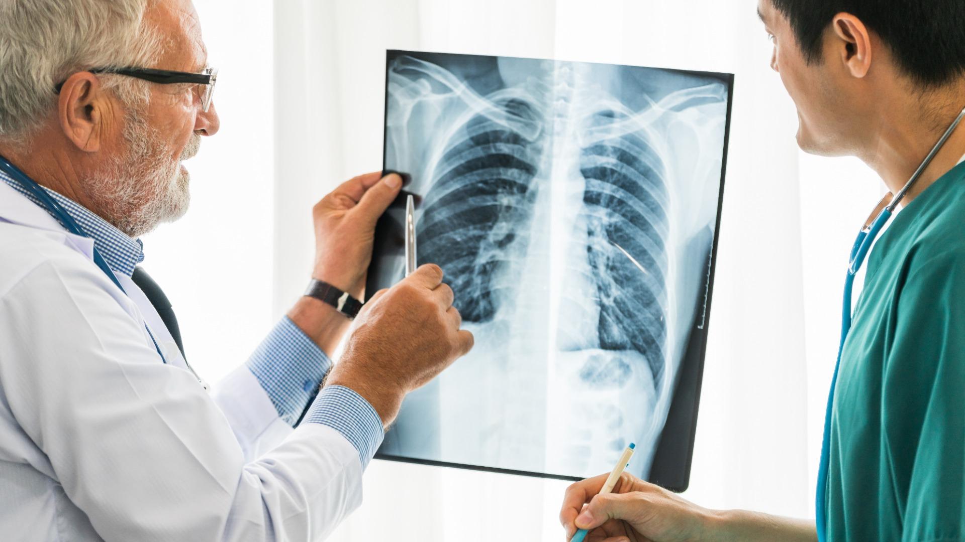 pajak rokok elektrik