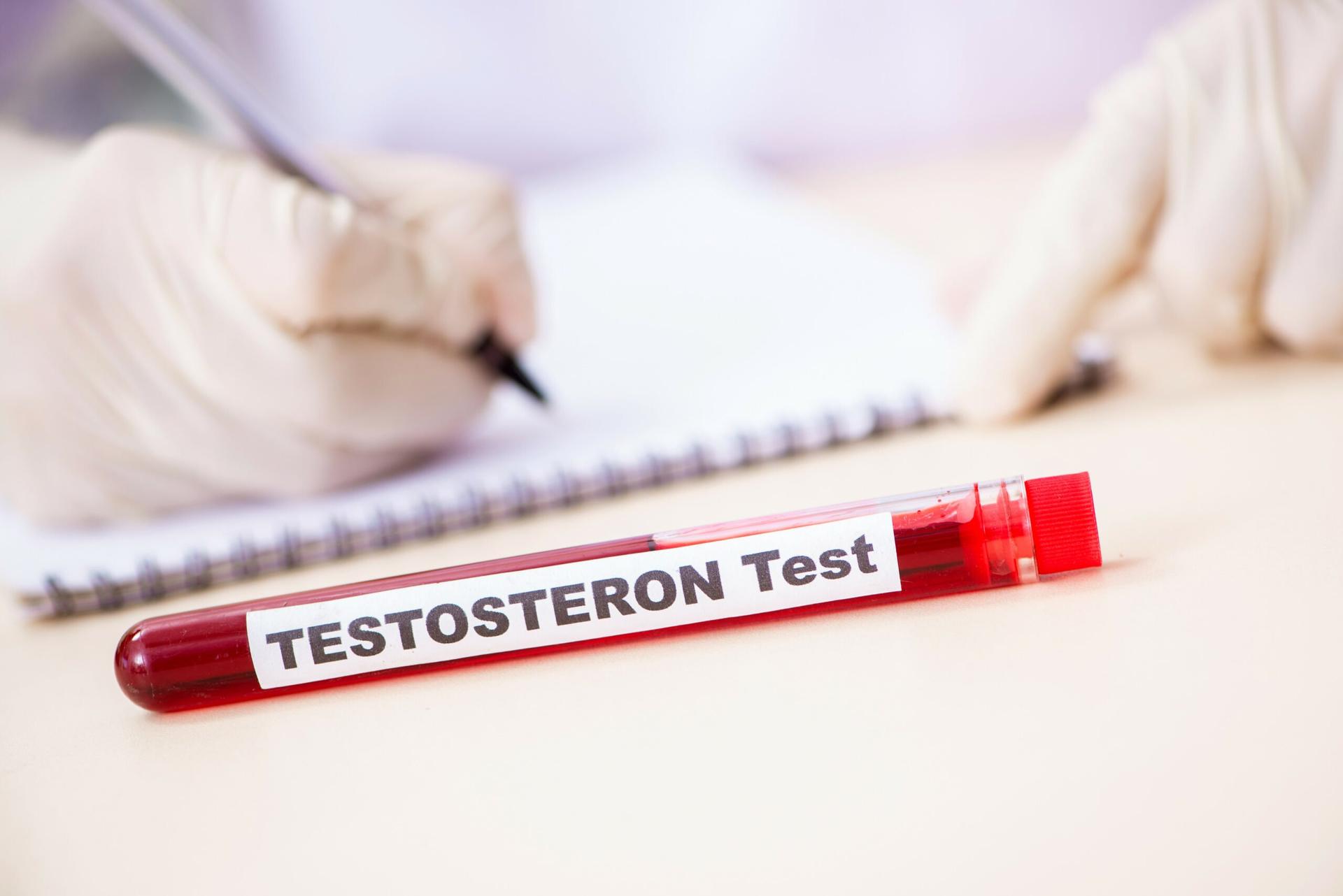 testosteron