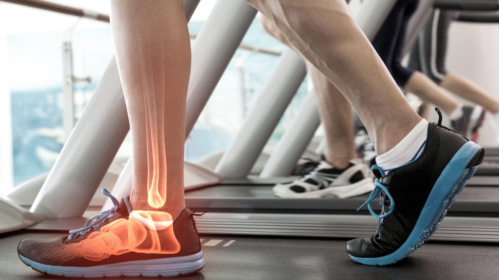 suplemen imboost bone